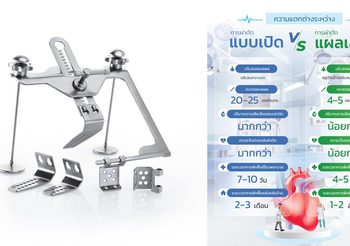 ทำความรู้จัก “เทคนิคผ่าตัดหัวใจแผลเล็ก” ทางเลือกใหม่เพื่อคุณภาพชีวิตคนไข้ที่ดีกว่า