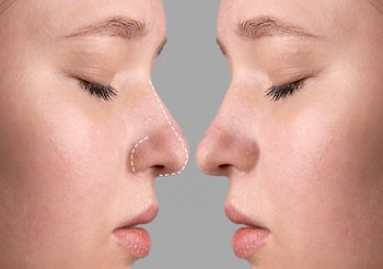 เช็กเลย โหงวเฮ้งจมูก เศรษฐี ของผู้ที่มีอายุ 41-50 ปีโดย อ.ตงฟางซินแซ