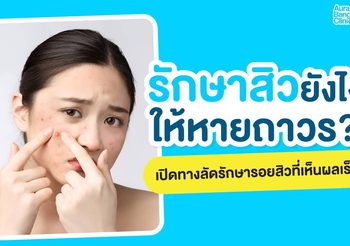 รักษาสิวยังไงให้หาย ลดการเกิดสิวอักเสบ พร้อมวิธีฟื้นฟูรอยสิว