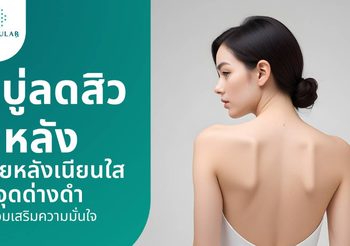สบู่ลดสิวที่หลัง เผยหลังเนียนใสไร้จุดด่างดำ มั่นใจตั้งแต่ครั้งแรก