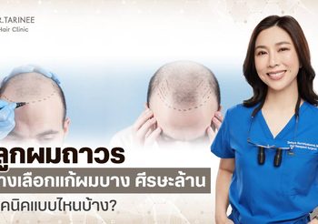 ปลูกผม รักษาผมบาง ศีรษะล้านดีไหม มีเทคนิคปลูกผมอะไรบ้าง?