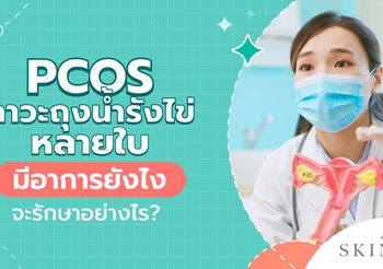 PCOS ภาวะถุงน้ำรังไข่หลายใบ อาการอย่างไร รักษาหายไหม?