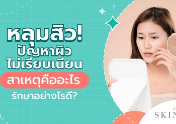 หลุมสิว ผิวเป็นบ่อ เกิดจากอะไร ดูแลรักษาอย่างไรได้บ้าง?