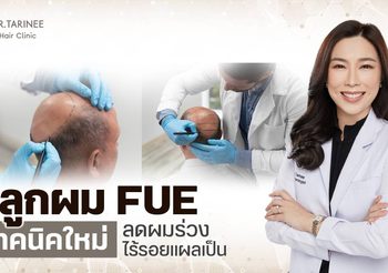 ปลูกผม FUE ไร้แผลผ่าตัด คืนความมั่นใจแบบไม่ต้องพักฟื้น