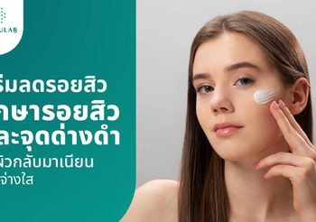 ครีมลดรอยสิว ตัวช่วยจัดการรอยสิวและจุดด่างดำ เผยผิวเนียนใส