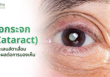 ต้อกระจก (Cataract) คืออะไร? รู้จักโรคต้อกระจก รักษาได้ไหม