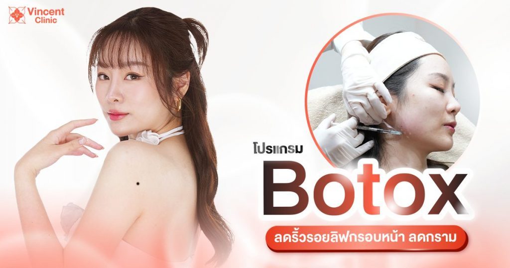 โบท็อก
