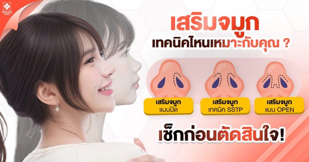 เสริมจมูก มีกี่เทคนิค?