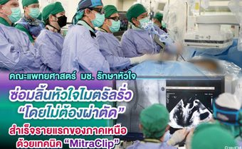 แพทย์ มช. ซ่อมลิ้นหัวใจไมตรัลรั่ว “ไม่ต้องผ่าตัด” สำเร็จรายแรกของภาคเหนือ