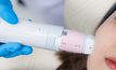 Volnewmer คืออะไร? ตอบทุกข้อสงสัยเรื่องเครื่องยกกระชับ