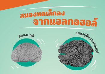 สมองหดเล็กเพราะดื่มแอลกอฮอล์…มีอยู่จริง