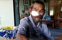 สุนัขจรจัดกัดเด็ก 3 ขวบและชาวบ้านบาดเจ็บสาหัส