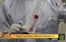 “หมอยง” เผย นำพลาสมา ผู้ที่หายป่วย ใช้รักษาโควิด-19