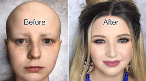 เมคอัพเปลี่ยนชีวิต! เมคอัพอาร์ติส เสกลุคใหม่ให้ผู้ป่วย คืนความมั่นใจกลับมาอีกครั้ง