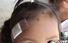ร้องขอความเป็นธรรมลูกสาวถูกสุนัขกัด