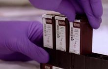 สถานการณ์ไวรัสโควิด-19 ในต่างประเทศ 28-07-63