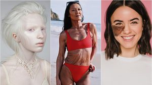 7 ผู้หญิงสตรองเผชิญกับโรคหายาก พลิกปมดอยเป็นความแกร่ง ส่งต่อแรงบันดาลใจ