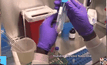 แอฟริกาใต้เตรียมทดลองวัคซีน HIV