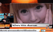 ใส่บิ๊กอาย ไร้วินัย เสี่ยงตาบอด