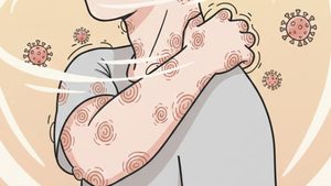 5 ข้อเข้าใจโรค ฝีดาษลิง ติดเชื้อได้อย่างไร มีวัคซีนป้องกันหรือยัง?