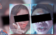 รพ.รามาฯ เร่งตรวจสาเหตุสาวทานอาหารเสริมดับ