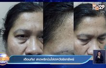 เตือนภัย! สาดพริกป่นใส่ตาหวังชิงทรัพย์