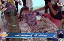 แพทย์อินเดีย เตือน พบผู้ป่วยเชื้อราดำเพิ่มสูงขึ้น
